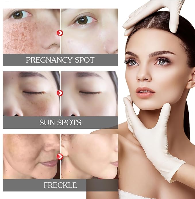 Eelhoe Dark Spot & Pigment Correcting Cream