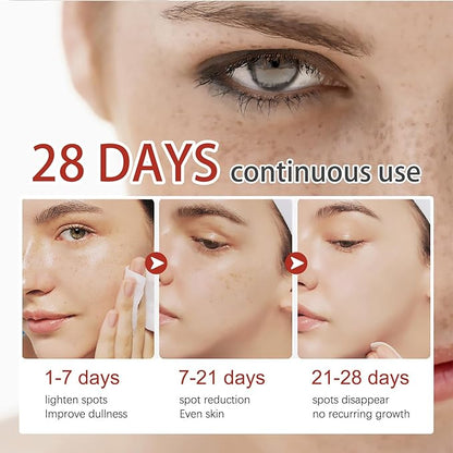 Eelhoe Dark Spot & Pigment Correcting Cream